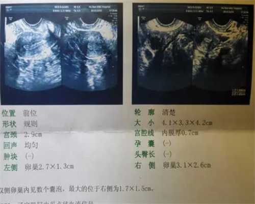 北京大学深圳试管婴儿哪个生试管技术好？